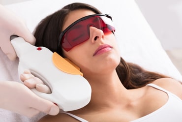 IPL Photofacial
